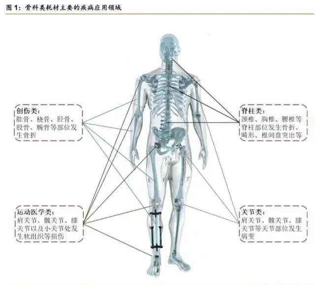 杏彩体育注册医疗设备常用医学仪器骨科疾病